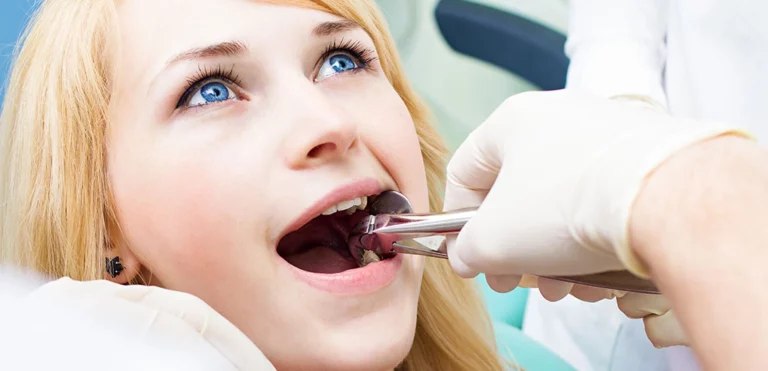 Can You Workout After Wisdom Teeth Removal?