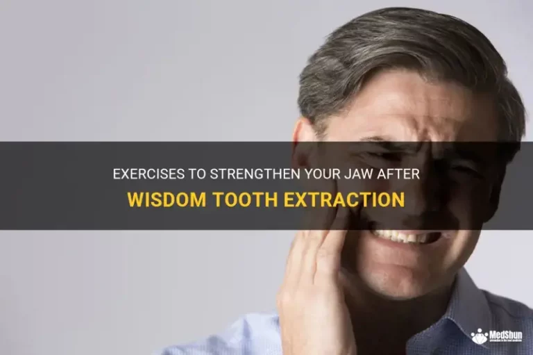 Can You Workout After Wisdom Teeth Removal Safely?