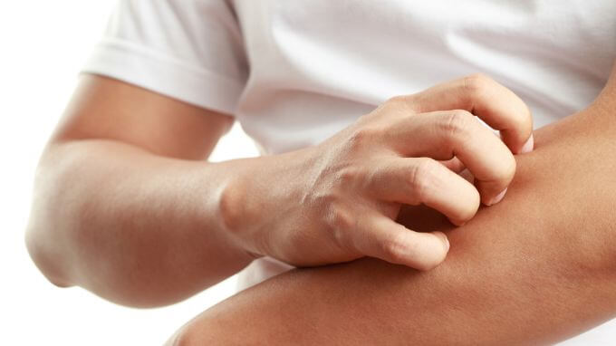 Why Am I Itchy When I Workout? (Real Causes)