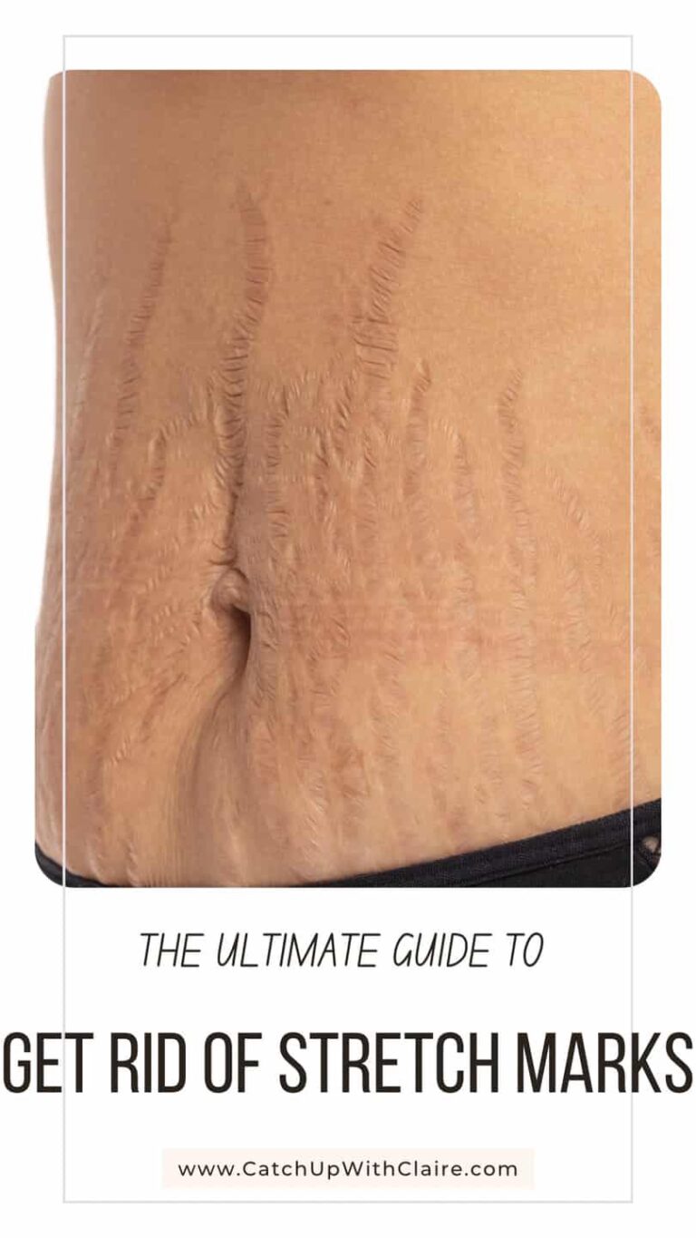 Can You Reduce Stretch Marks from Workouts?